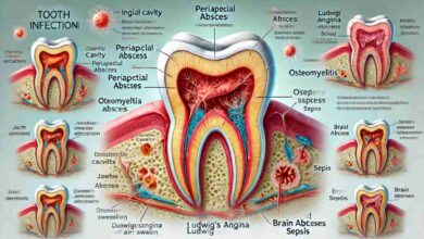 How Long Until a Tooth Infection Kills You