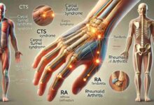 Two Conditions That Are Often Misdiagnosed as Carpal Tunnel Syndrome