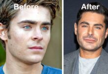 zac efron before and after