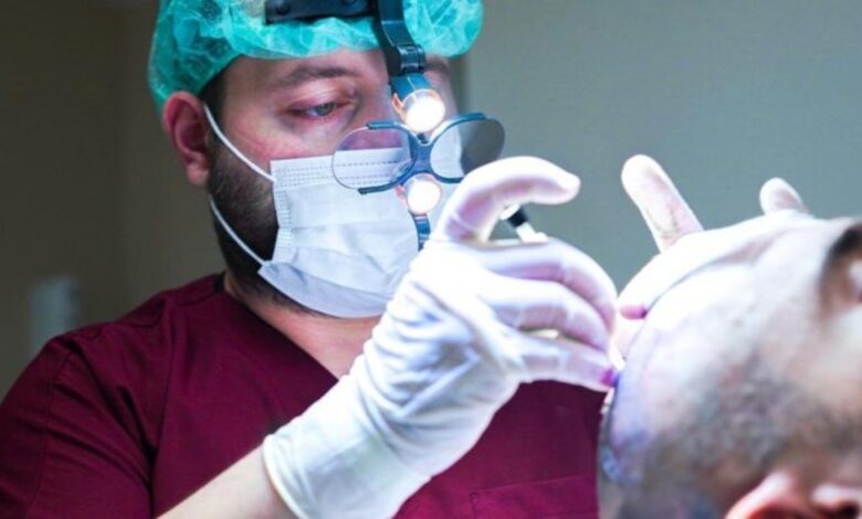 Hermest Is the Best Hair Transplant