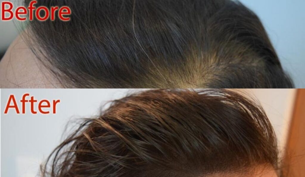 Managing Hair Loss