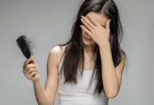 Managing Hair Loss