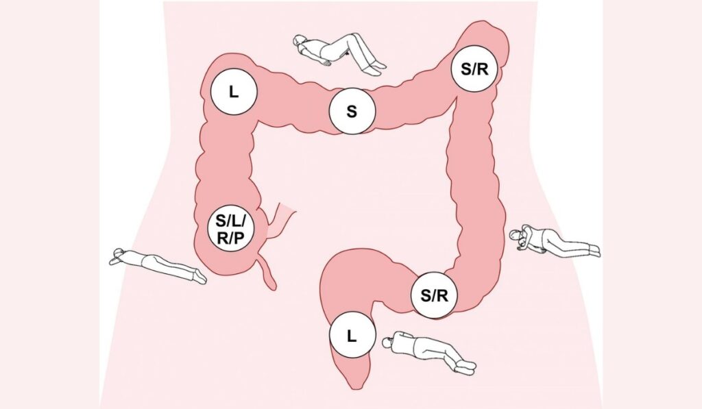 Right Colonoscopy