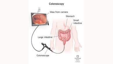 Right Colonoscopy