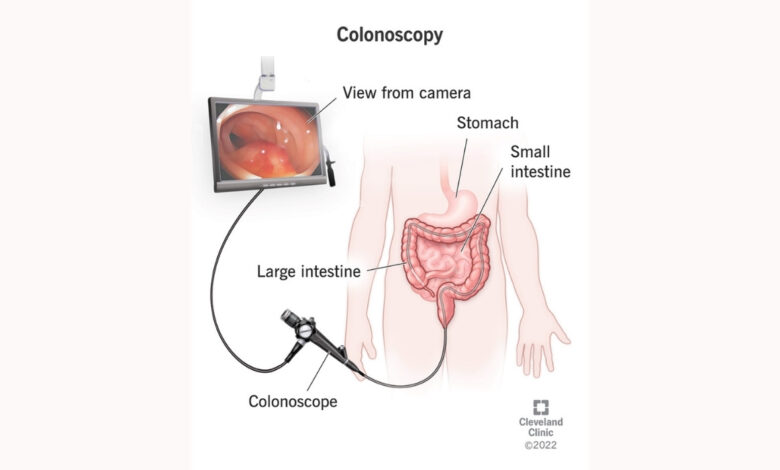 Right Colonoscopy